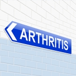 Arthritis Treatment in New York