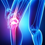 Stem Cell Repair For Knee Injuries - ACL, MCL, LCL, Arthritis