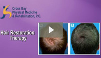 Hair Restoration Procedure