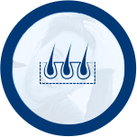 Hair Restoration