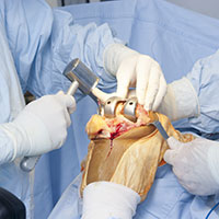 Stem Cell Therapy for Knee Injuries