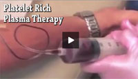 Platelet Rich Plasma